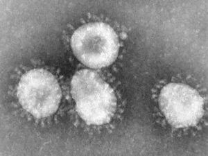Coronavirus. Autore CDC-Dr. Fred Murphy. No Copyright